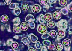 Ars Technica Unvaccinated Woman Becomes Sixth Measles Fatality in Pennsylvania Amid Widespread Outbreak