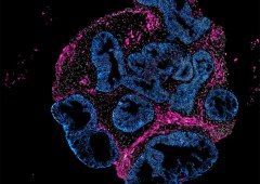 Intero Biosystems Kehittää Laboratoriossa Kasvatettuja Ihmisen Suolia Eläinkokeiden Korvaamiseksi Lääkeaineiden Kehityksessä