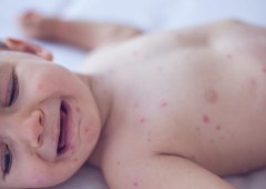 Pennsylvania Issues Alert on Dangerous Congenital Measles Amid Rising Cases
