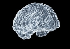 NVIDIA Highlights AI's Role in Accelerating Dementia Research