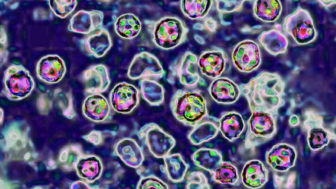 South Carolina's Measles Outbreak Spreads to Washington State via Multiple Domestic Imports
